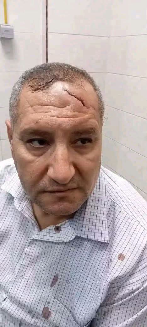 إصابة مدير مدرسة ميت الفرماوي