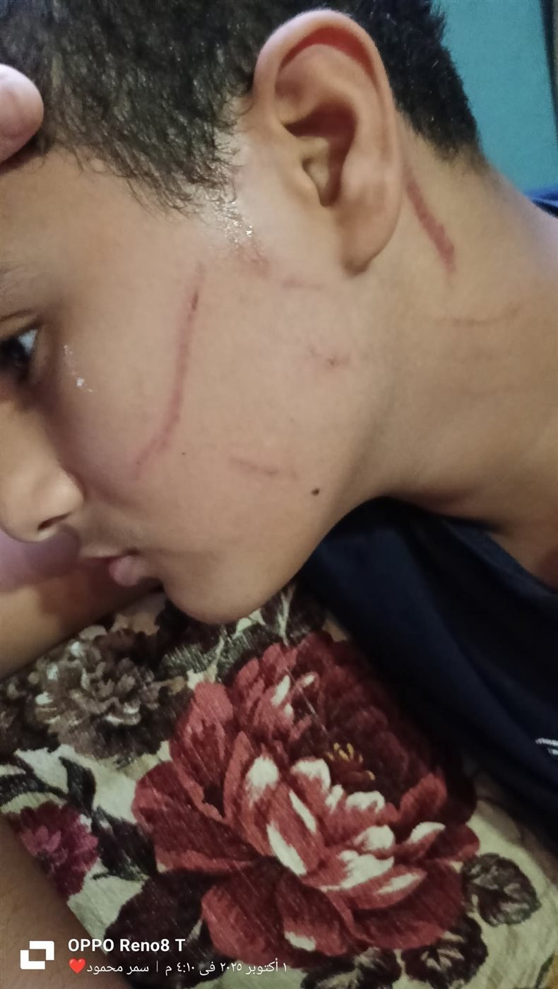 الاعتداء على طالب 