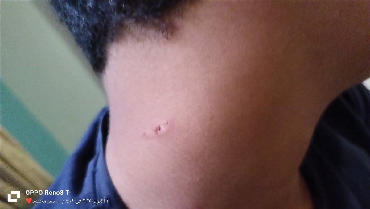 جانب من الاعتداء على طالب الإسكندرية 