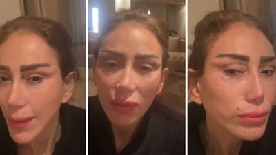 إحالة طبيب تجميل لبنانى للجنايات بواقعة تشويه وجه ريهام سعيد والتشهير بها