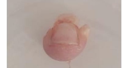 إصابة طفل داخل حضانة خاصة.. ووالده: 