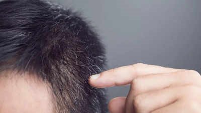 كيف يمكن منع ظهور الشعر الأبيض ومحاربة الشيخوخة؟ إليك هذه النصائح