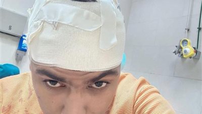 شاب بإمبابة: خالي نهب ميراث أمي ومزقني بـ14 غرزة