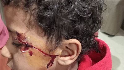 تحقيقات موسعة في اعتداء طالبين على زميلهما داخل مدرسة بسوهاج