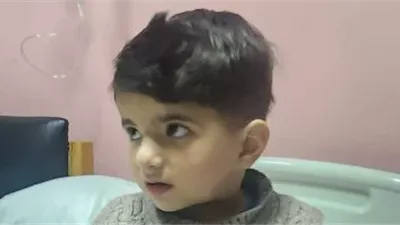 نجاح أول جراحة قلب مفتوح لطفل من غزة بمستشفى أبو الريش الياباني