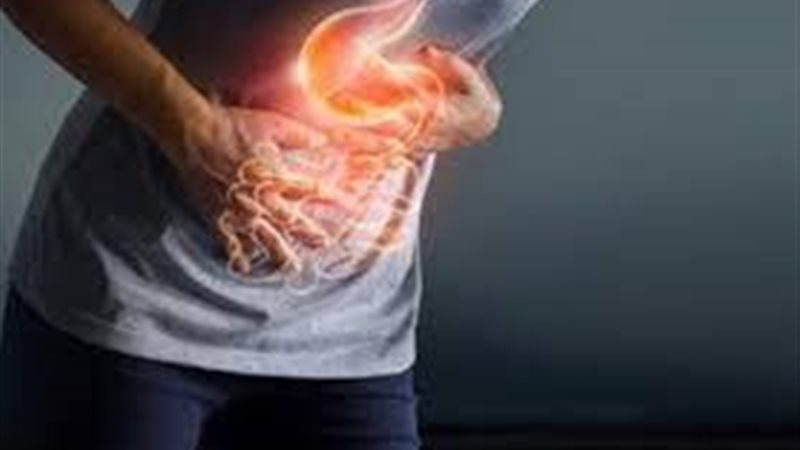 حرقة المعدة