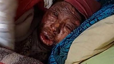 مبيض محارة يحرق زوجته أمام أطفالهما في كرداسة بسبب مصاريف المنزل