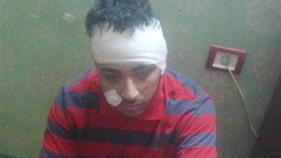 200 غرزة بسبب كلب.. تفاصيل الاعتداء على شاب من ذوي الهمم بكرداسة