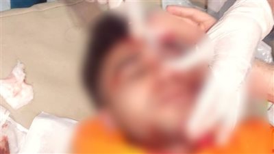 إصابة طالب بكسر في الجمجمة بعد اعتداء خلال السحور بالغردقة