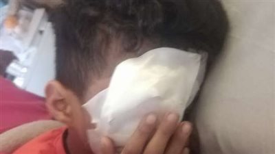 انفجار عين طفل بسبب الألعاب النارية في الوادي الجديد