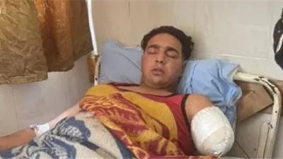 بعد هجوم الأسد عليه.. بتر ذراع مساعد مدرب الأسود بسيرك طنطا 