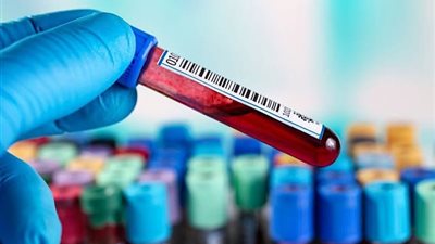 هل فحص دم لمرض الزهايمر يكشف مدى تطور حالة الدماغ؟