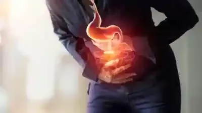 سرطان الأمعاء الأكثر انتشارًا بين 