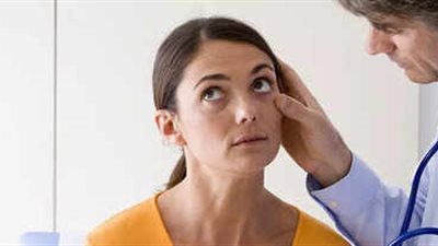 5 أعراض تدل على نقص الحديد بالجسم.. أبرزها الإرهاق المستمر بلا سبب