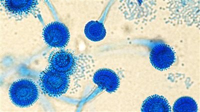  دراسة تحذر: فطريات قاتلة تهدد ملايين البشر في آسيا وأوروبا والأمريكيتين