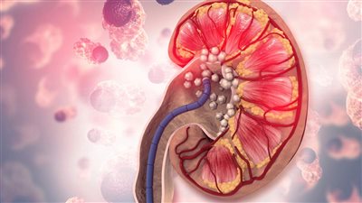 7 فواكه وخضراوات خالية من البذور تقيك من حصوات الكلى