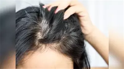 5 نصائح لوقف الشيب المبكر والحفاظ على شعر كثيف وصحي