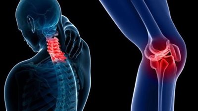 منهم البرقوق المجفف .. 4 أطعمة غنية بالكالسيوم تحافظ على قوة العظام