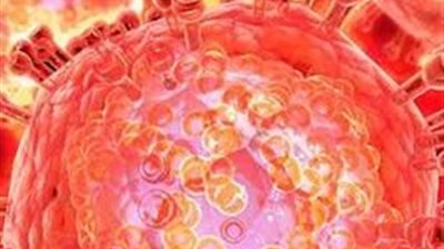 على خطى كورونا.. الإيدز يهدد الفلبين والعالم يتأهب