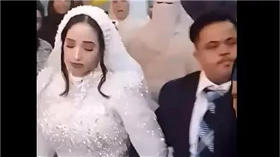 العروس قاصر وتزوجها بعقد عرفي.. مفاجأة في واقعة زواج شاب من ذوي متلازمة داون