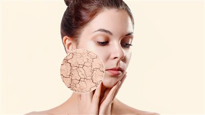 علامات تدل على جفاف البشرة.. أبرزها البثور و الجلد المشدود 