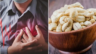 هل تناول مكسرات الكاجو يرفع الكوليسترول؟ طبيبة تغذية تكشف عن آثاره الجانبية