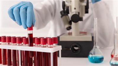 تقنية ثورية تساعد في التنبؤ بالعمر بفحص دم بسيط.. ما القصة؟  