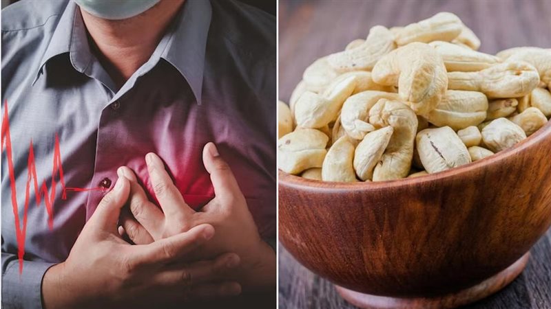 أضرار الكاجو