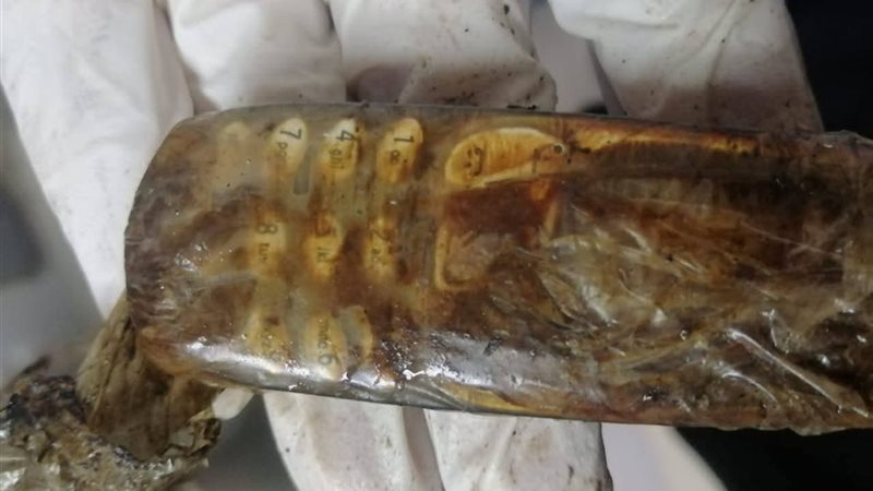 استخراج هاتف من معدة