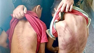 عنف أب يمزق براءة طفلين في حلوان.. والجيران أنقذوا الموقف
