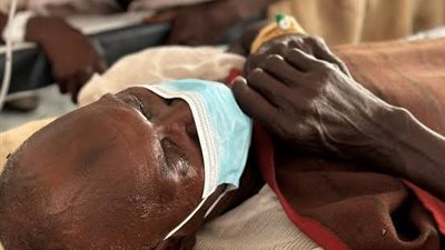 وفيات الكوليرا تقفز إلى أعلى حصيلة منذ 1999.. 7870 وفاة خلال عام