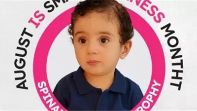 يحتاج حقنة بـ106 ملايين جنيه لعلاجه.. الطفل علي اصبح حديث السوشيال ميديا ما القصة ؟ 