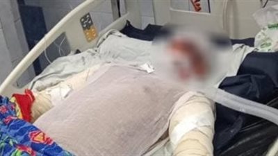 وفاة بطل حريق مترو شبرا الخيمة متأثراً بإصاباته