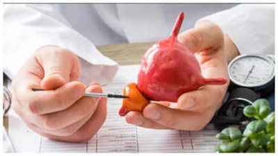 أطباء يحذرون: علامات مبكرة لسرطان البروستاتا قد يتجاهلها الرجال