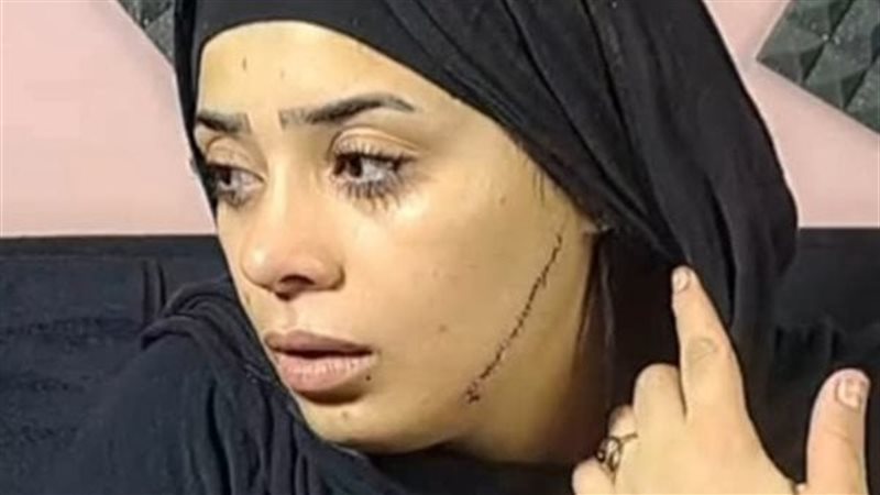 منصورة ضحية نار الغيرة