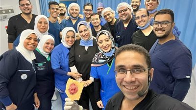 إنجاز طبي عالمي.. اعتماد أول تقنية مصرية من الجمعية الأوروبية لعلاج الأكالازيا بالمنظار