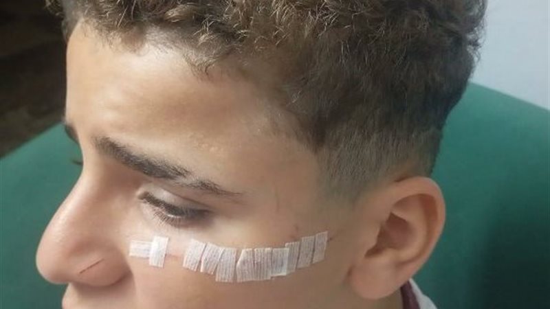 الطالب المصاب