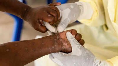 سلالة جديدة شديدة من 