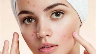  5 نصائح ذهبية لبشرة نضرة في موسم الخريف.. والتخلص من حب الشباب 