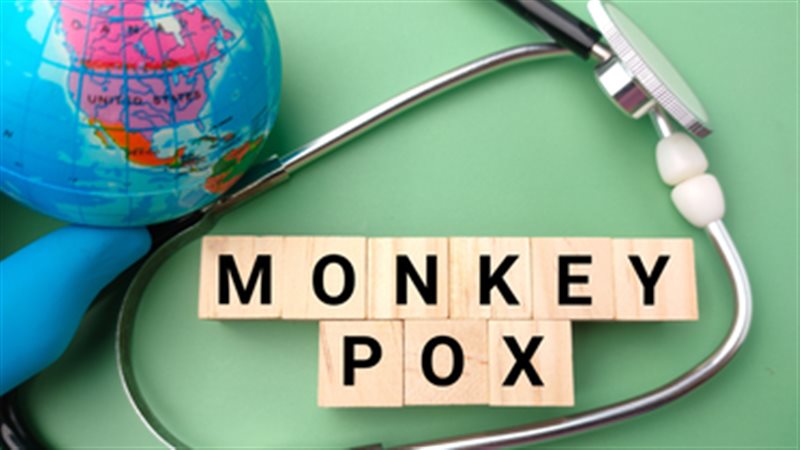 جدري القرود 