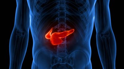 تشخيص متأخر ومعدلات وفاة عالية.. الوجه القاسي لسرطان البنكرياس