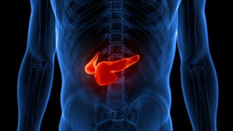 سرطان البنكرياس 