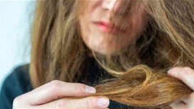 5 علاجات شائعة يجب تجنبها لحماية الشعر من التساقط