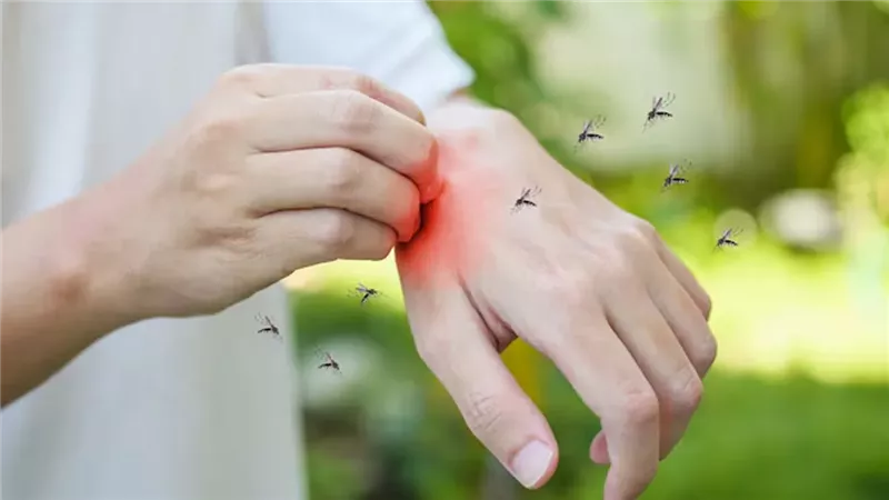 فيروس الشيكونغونيا