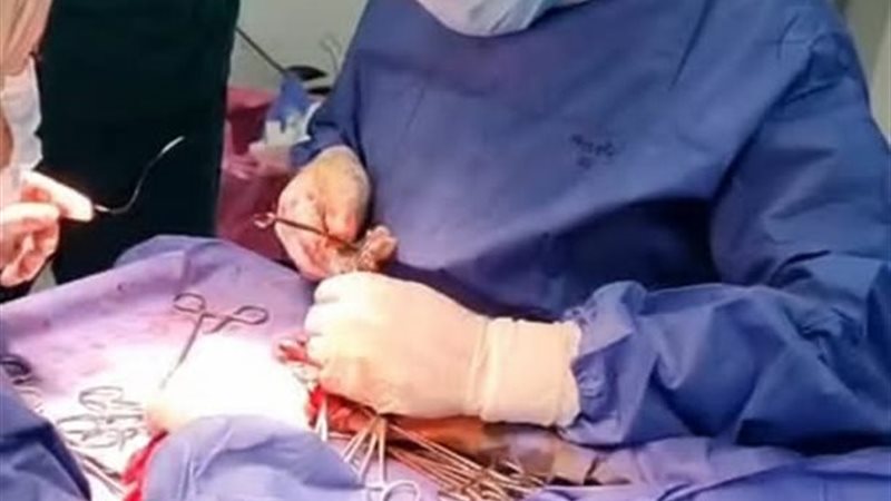 العملية الجراحية