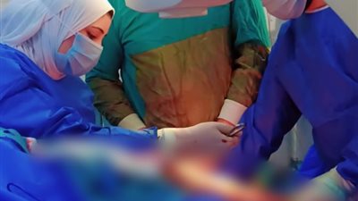 بتقنية «MIPO».. نجاح جراحة دقيقة لترميم كسر معقد لمريضة سكري بمستشفى مغاغة