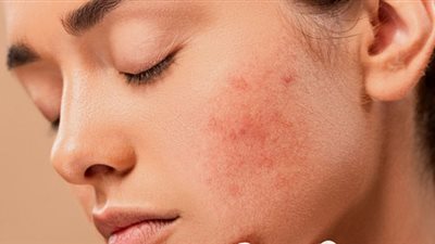 7 علامات تظهر على  الوجه تكشف عن التوتر