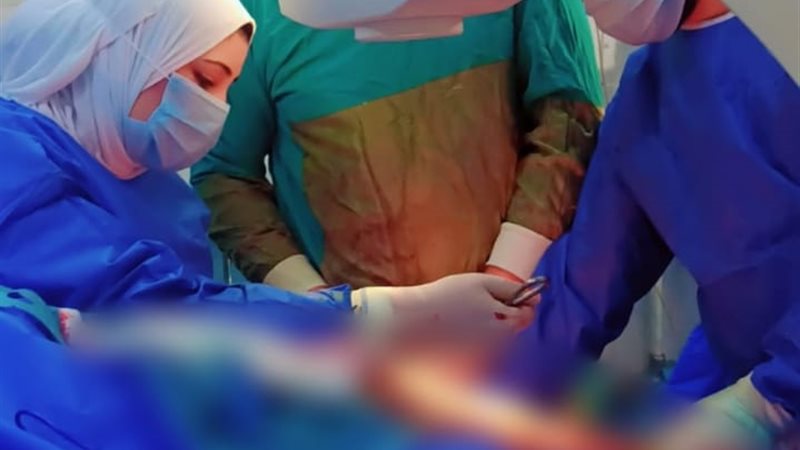 أثناء إجراء العملية