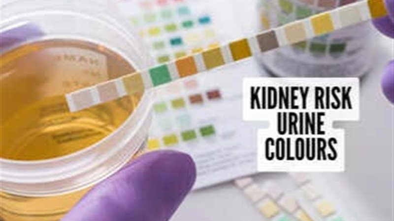 علامات لون البول