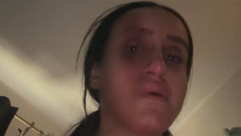 الزوجة ضحية زوجها